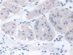 TCP-1 beta Antibody in Immunohistochemistry (Paraffin) (IHC (P))