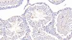 CHRDL1 Antibody in Immunohistochemistry (Paraffin) (IHC (P))