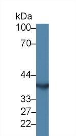 CHRDL1 Antibody in Western Blot (WB)