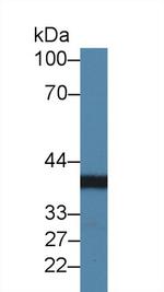 CHRDL1 Antibody in Western Blot (WB)