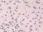 CD15 Antibody in Immunohistochemistry (Paraffin) (IHC (P))