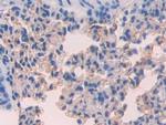 CD15 Antibody in Immunohistochemistry (Paraffin) (IHC (P))