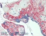 B7-H3 Antibody in Immunohistochemistry (Paraffin) (IHC (P))