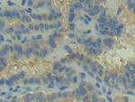 C2 Antibody in Immunohistochemistry (Paraffin) (IHC (P))