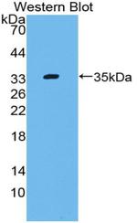 Complement C4 Antibody in Western Blot (WB)