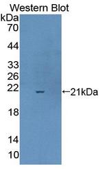 CPLX1 Antibody in Western Blot (WB)