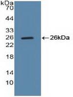 Cyclin B1 Antibody in Western Blot (WB)