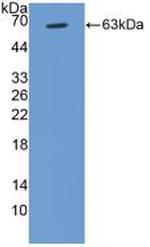 Cyclin D1 Antibody in Western Blot (WB)