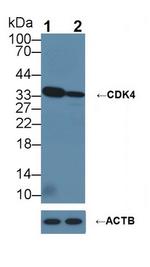 CDK4 Antibody in Western Blot (WB)