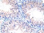 CYP21A2 Antibody in Immunohistochemistry (Paraffin) (IHC (P))