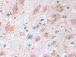 SERPINB9 Antibody in Immunohistochemistry (Paraffin) (IHC (P))