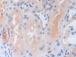 SERPINB9 Antibody in Immunohistochemistry (Paraffin) (IHC (P))