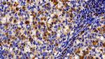 TRAIL-R2 (DR5) Antibody in Immunohistochemistry (Paraffin) (IHC (P))