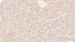 TRAIL-R2 (DR5) Antibody in Immunohistochemistry (Paraffin) (IHC (P))