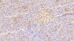 TRAIL-R2 (DR5) Antibody in Immunohistochemistry (Paraffin) (IHC (P))