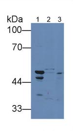 TRAIL-R2 (DR5) Antibody in Western Blot (WB)