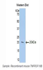 TRAIL-R2 (DR5) Antibody in Western Blot (WB)