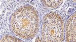 TRAIL-R2 (DR5) Antibody in Immunohistochemistry (Paraffin) (IHC (P))