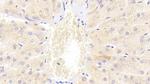 TRAIL-R2 (DR5) Antibody in Immunohistochemistry (Paraffin) (IHC (P))