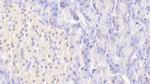 TRAIL-R2 (DR5) Antibody in Immunohistochemistry (Paraffin) (IHC (P))