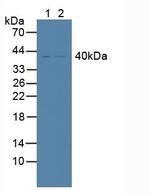 TRAIL-R2 (DR5) Antibody in Western Blot (WB)