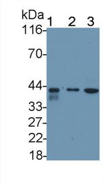 TRAIL-R2 (DR5) Antibody in Western Blot (WB)