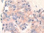 CD148 Antibody in Immunohistochemistry (Paraffin) (IHC (P))