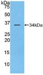 CD148 Antibody in Western Blot (WB)