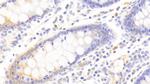 DPP3 Antibody in Immunohistochemistry (Paraffin) (IHC (P))