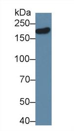 DLG5 Antibody in Western Blot (WB)