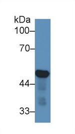 NSE Antibody in Western Blot (WB)