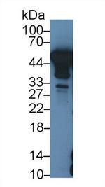 NSE Antibody in Western Blot (WB)