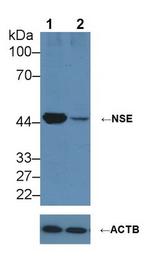 NSE Antibody in Western Blot (WB)