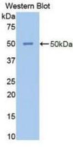 NSE Antibody in Western Blot (WB)