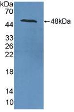 NSE Antibody in Western Blot (WB)