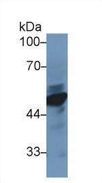 NSE Antibody in Western Blot (WB)