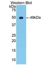 NSE Antibody in Western Blot (WB)