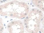 CRM1 Antibody in Immunohistochemistry (Paraffin) (IHC (P))