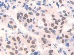 FAM19A3 Antibody in Immunohistochemistry (Paraffin) (IHC (P))