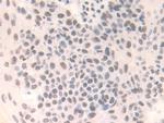 FAM19A3 Antibody in Immunohistochemistry (Paraffin) (IHC (P))