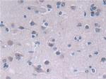 FADS2 Antibody in Immunohistochemistry (Paraffin) (IHC (P))