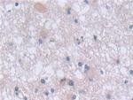 FADS2 Antibody in Immunohistochemistry (Paraffin) (IHC (P))