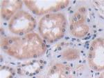 FADS2 Antibody in Immunohistochemistry (Paraffin) (IHC (P))