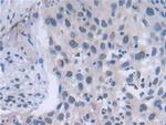 FADS2 Antibody in Immunohistochemistry (Paraffin) (IHC (P))