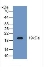 FADS2 Antibody in Western Blot (WB)