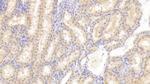 FIGN Antibody in Immunohistochemistry (Paraffin) (IHC (P))