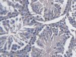 FKBPL Antibody in Immunohistochemistry (Paraffin) (IHC (P))