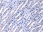 Fumarase Antibody in Immunohistochemistry (Paraffin) (IHC (P))