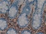 Galectin 1 Antibody in Immunohistochemistry (Paraffin) (IHC (P))