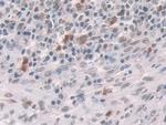 Glucocorticoid Receptor Antibody in Immunohistochemistry (Paraffin) (IHC (P))